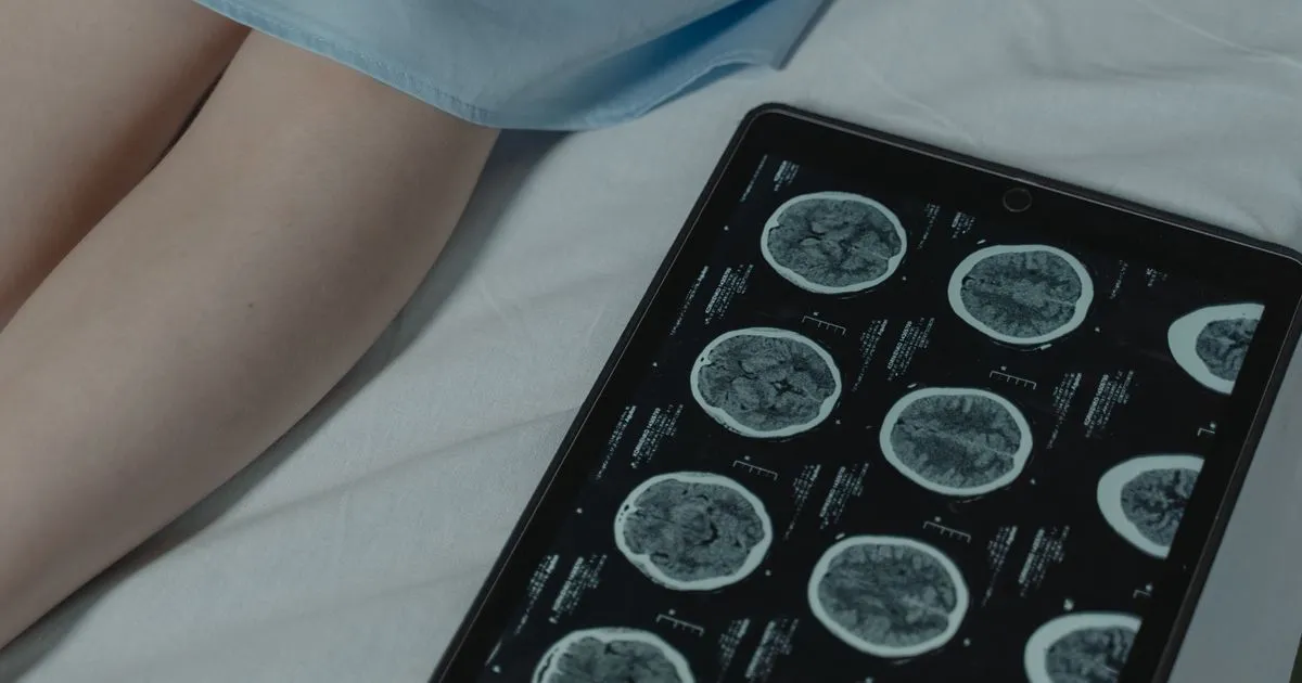 Unequal access to neurological therapy condemns thousands of brain injury patients